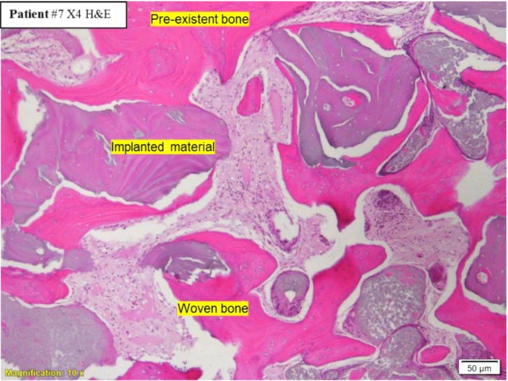 Representative histological image from the study