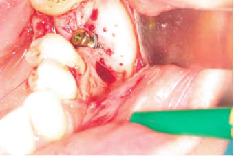 the-buccal-view